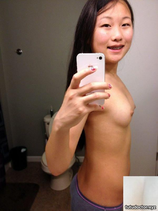 Netizen took a selfie, braces are too ugly · photo 7 of 11