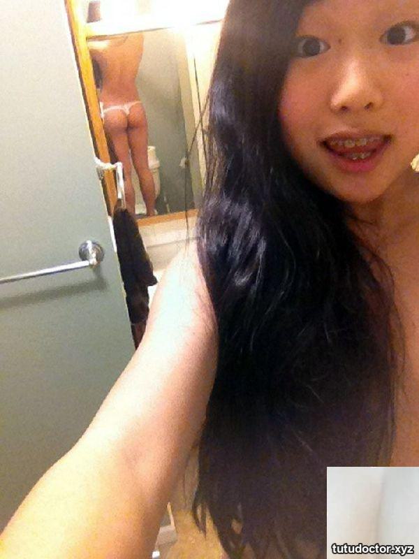 Netizen took a selfie, braces are too ugly · photo 8 of 11