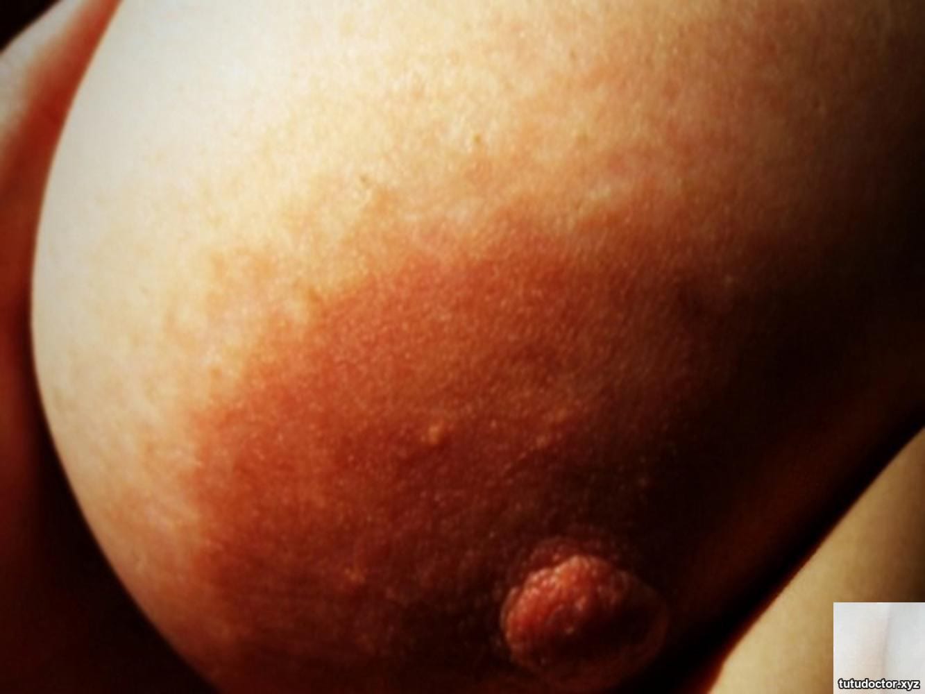 After giving birth to a new baby, my breasts grew bigger · photo 11 of 12